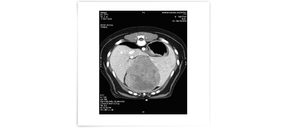 症例4：肝臓腫瘍